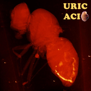 Striking image: Diet-dependent uric acid pathologies in Drosophila