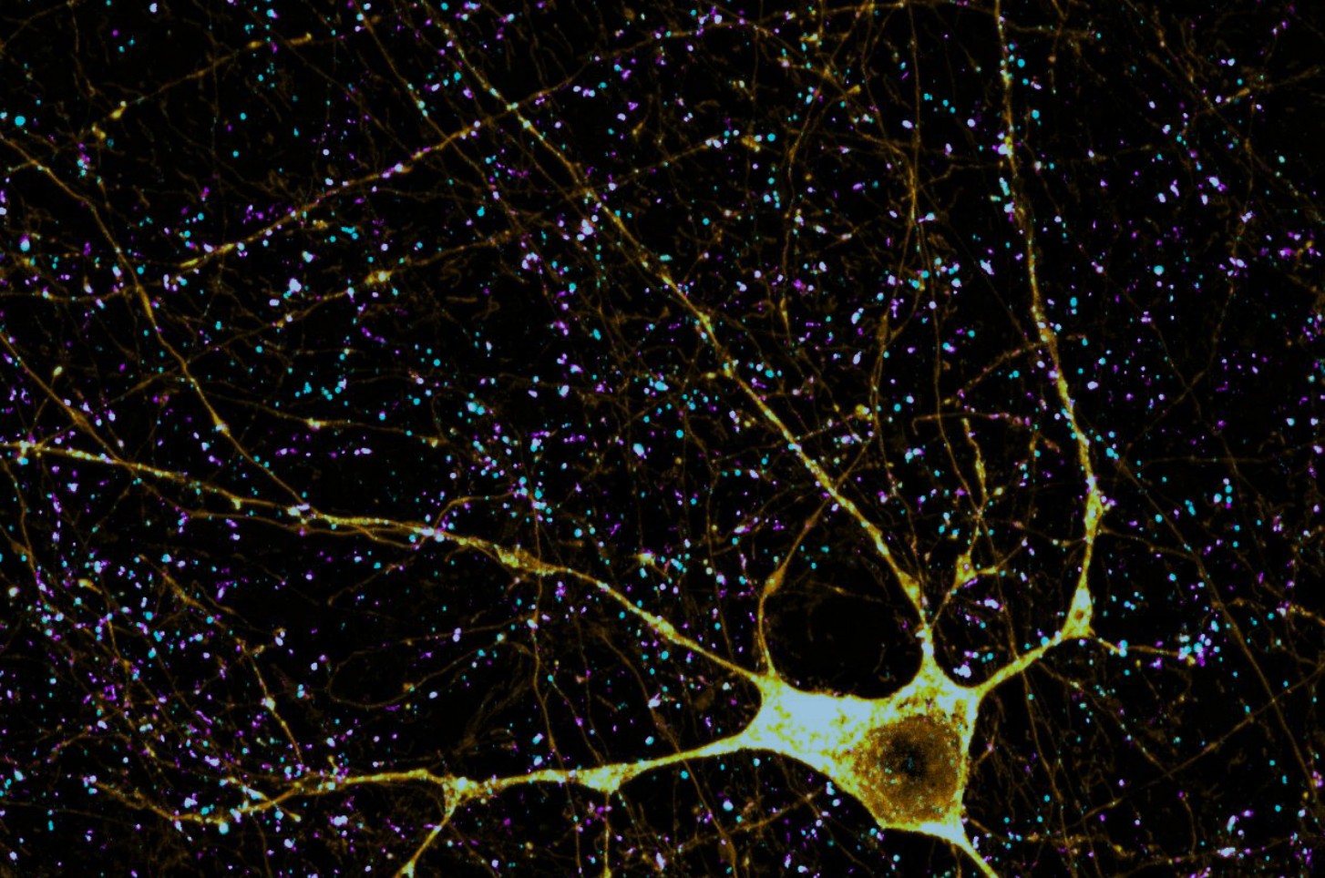 Discovery shines light on a cascade of events that occurs when toxic tau impacts synapses, suggesting new mechanisms for neurodegeneration